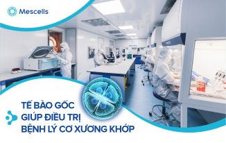 cong-nghe-te-bao-goc-dieu-tri-benh-ly-co-xuong-khop-1